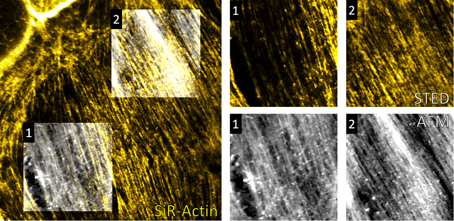 Correlative STED/AFM study on live-cells published in Frontiers in Neuroscience (2017). 