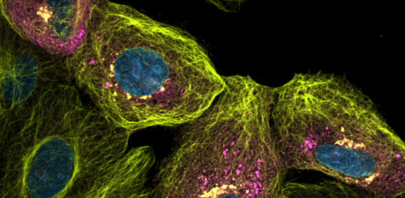 SARS-CoV-2 infected Vero cells