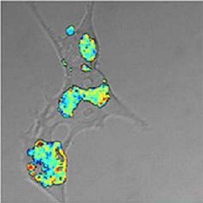Aggregation rates of amyloid beta increase dramatically in acidic vesicles